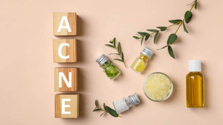 Cubos formando a palavra "acne" e, ao lado, recipientes com produtos para a pele